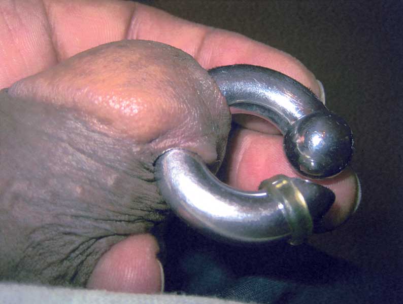 21A